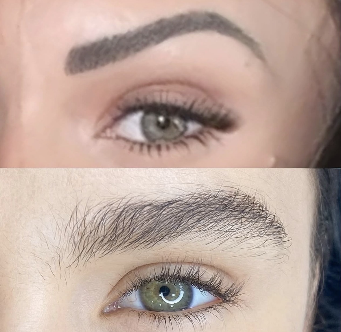 Antes e depois detalhado de sobrancelhas regeneradas com exossomos